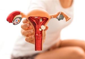 أسباب لحمية الرحم- هل تمنع حدوث الحمل؟