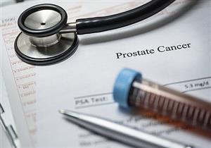 اكتشاف علاج جديد لمرضى سرطان البروستاتا 