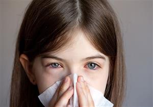 تأثير الإنفلونزا على العين- 6 نصائح لحمايتها
