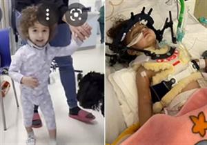 طفلة تذهل الأطباء بقدرتها على المشي من جديد بعد حادث مروع