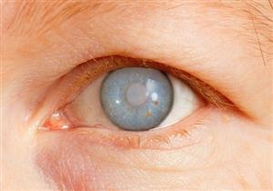 أول مريض يجري عملية جديدة لعلاج الجلوكوما في العينين