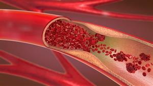  أعراض غير مباشرة للإصابة بـ"ضعف الأوعية الدموية"