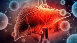 الصحة: لا يوجد خطر من انتقال مرض الالتهاب الكبدي الحاد بين الأشخاص