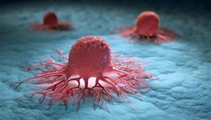 حقن أول مريض بشري بفيروس قد يقتل السرطان