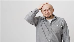 لماذا يصاب الرجل القصير بالصلع؟.. العلم يكشف السبب