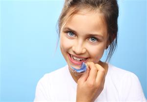 متى يمكن تركيب تقويم الأسنان للأطفال؟- إليكِ السن المناسب