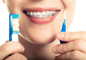 كيف تختار فرشاة تقويم الأسنان؟