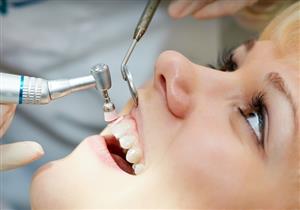 فوائد تلميع الأسنان- متى يكون ممنوعًا؟