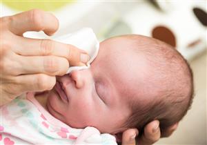 إفرازات العين عند الأطفال حديثي الولادة- هل لها دلالات خطيرة؟