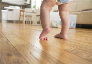 تقوس الساقين عند الأطفال- متى يتحول إلى عرج؟