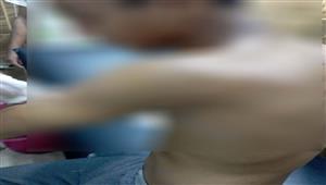 105 غرز.. إصابة طالب في مشاجرة بالقليوبية