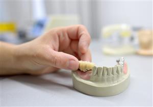 س & ج- طبيب يكشف معلومات هامة عن جسر الأسنان