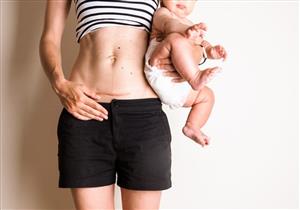 على الأم والطفل- آثار جانبية مستقبليىة محتملة للولادة القيصرية