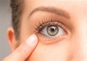 متى يحتاج انتفاخ العيون إلى عملية جراحية؟