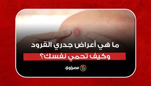 بعد ظهور أول إصابة في مصر.. ما أعراض جدري القرود وكيف تحمي نفسك؟
