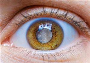 طبيب عيون يحذر: هذا المرض يسبب العمى