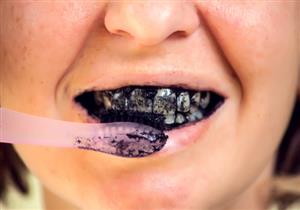 تبييض الأسنان بالفحم- حقيقة أم خرافة؟