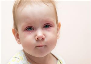 ماذا تفعل عند دخول الدواء في عين الرضيع؟