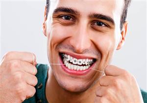 تقويم الأسنان بعد سن الأربعين- المميزات والعيوب