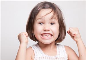 4 علاجات لتسوس الأسنان اللبنية في المنزل