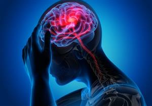 أعراضهما متشابهة- كيف تفرق بين السكتة الدماغية ونزيف المخ؟