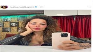  مني زكي تحتفل باليوم العالمي للمرأة ونادين نجيم تظهر بجروح على وجهها.. لقطات النجوم على مدار 24 ساع