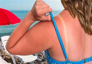 هل يسبب التقشير الشمسي للجلد أضرارًا خطيرة؟
