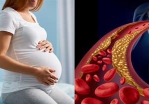هل الحمل يسبب ارتفاع الكوليسترول؟