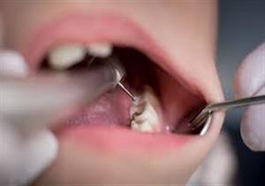 4 أنواع لأشعة الأسنان- ما الفرق بينهم؟