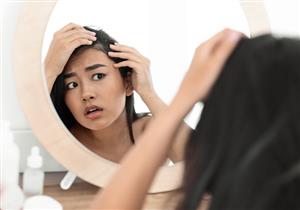 شعرِك تاج جمالِك- 4 منتجات لعلاجه من التساقط