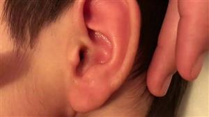 5 أمراض تكشفها الأذن