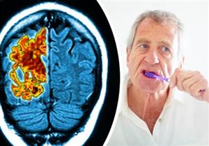 العقل السليم في الفم النظيف- غسل الأسنان يحمي مخك من مرض خطير