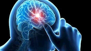  جربها وانقذ حياتك.. حيلة بسيطة قد تكشف إصابتك بورم في المخ (فيديو)