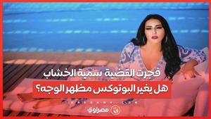سمية الخشاب تُفجر القضية.. هل يغير البوتوكس مظهر الوجه؟