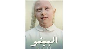 حسام داغر يعلن اختيار فيلمه القصير "ألبينو" في مهرجان مدريد السينمائي