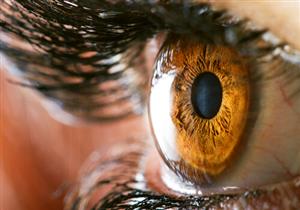 يصيب العين- تحذيرات من وباء قد يجتاح العالم 