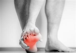 انتبه- 6 أعراض تظهر على القدمين تنذر بنقص فيتامين هام بالجسم