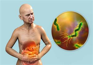 من فمك- كيف تكتشف الإصابة بجرثومة المعدة؟