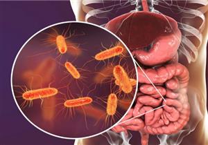 E. coli تحل لغز مرض أهالي أسوان إليك كل ما تريد معرفته