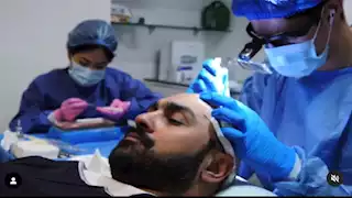 "بينهم صلاح والمحمدي".. 25 صورة لنجوم كرة قدم أجروا عملية زراعة شعر