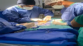 جراحة دقيقة تنقذ حياة طفلة بالمنوفية من ثقب نادر بالأمعاء- صور