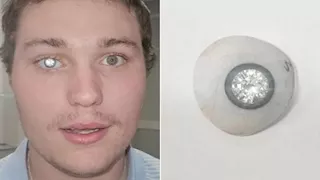 مثبتة في عينه.. صاحب متجر مجوهرات يثير الجدل بـ ماسة عيار 2 قيراط (فيديو)