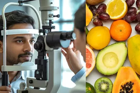 لحماية عينيك من المياه البيضاء- 4 فواكه تناولها يوميًا