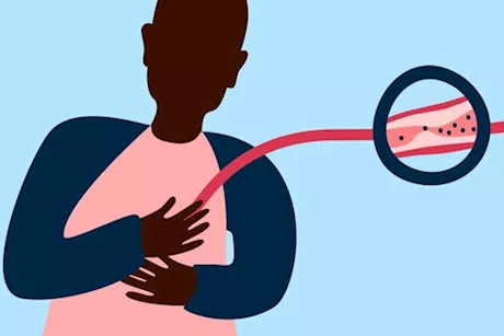 ليس ألم الصدر- هذا هو أول عرض يكشف إصابتك بالنوبة القلبية