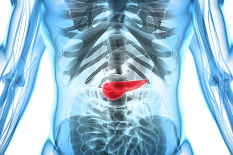 التهاب أو سرطان- 5 أعراض مبكرة تخبرك بأن بنكرياسك مريض