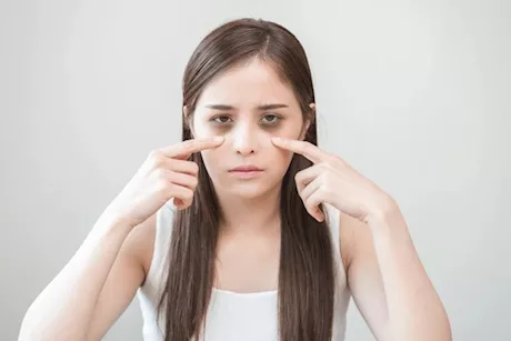 وداعًا للهالات السوداء- 8 أطعمة تساعد على تفتيحها