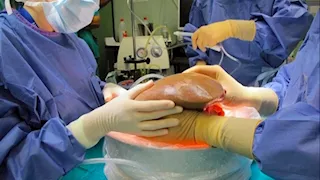 أستاذ زراعة كبد: "ميثاق القاهرة" خطوة لتنظيم أكثر أخلاقية لزراعة الأعضاء