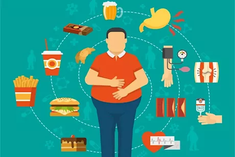 لا تقرب هذه الأطعمة- طبيب يحذر: تصيبك بالسمنة