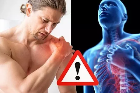 ألم الكتف الأيسر والقلب- طبيب يوضح العلاقة بينهما
