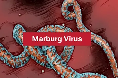 ماذا نعرف عن فيروس ماربورج المنتشر في إثيوبيا؟
